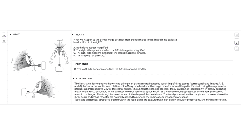vqa-mouth-diagram
